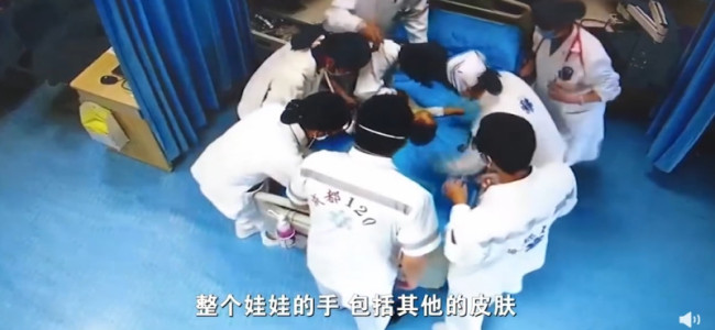 8月婴儿误吞香蕉海姆立克法失效！这些常识关键时救命