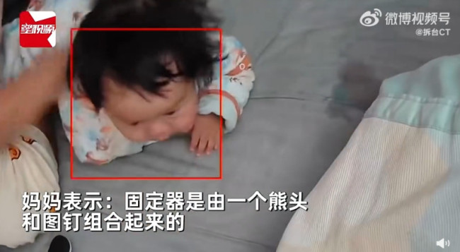 妈妈以为宝宝吐奶拍背后吐出图钉 医生：极其危险