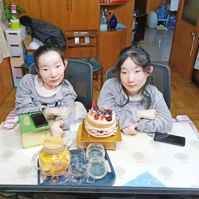 男子去世捐眼角膜 留下一对渐冻症女儿