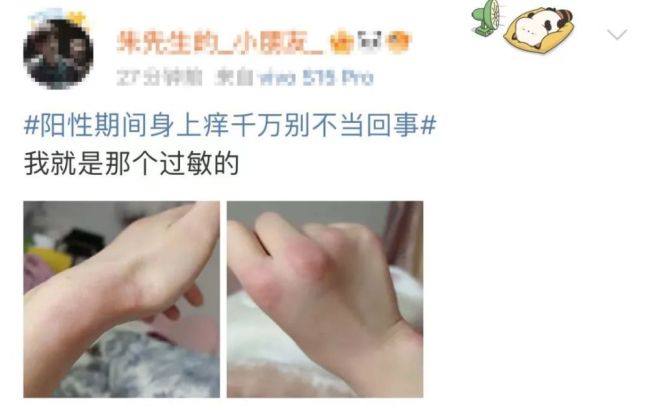 感染后出现这种情况必要时立即就医！高度过敏会引起窒息