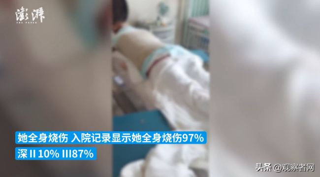 母亲称女儿拒绝追求被男孩泼汽油烧伤，凶手事后跳河自杀了