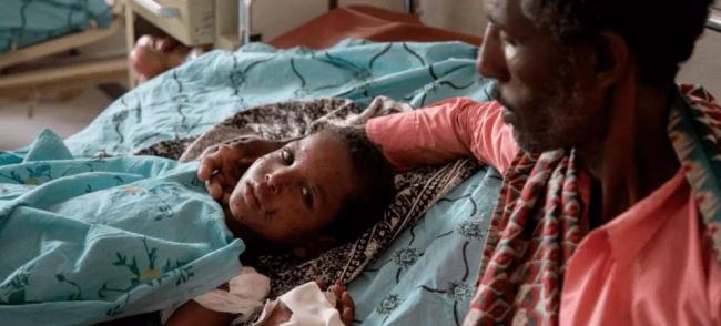 在埃塞俄比亚提格雷州首府默克莱的一家医院，一名因捡拾手榴弹而被炸伤的10岁男孩在病床上休息。（图源：央视新闻 联合国儿童基金会）