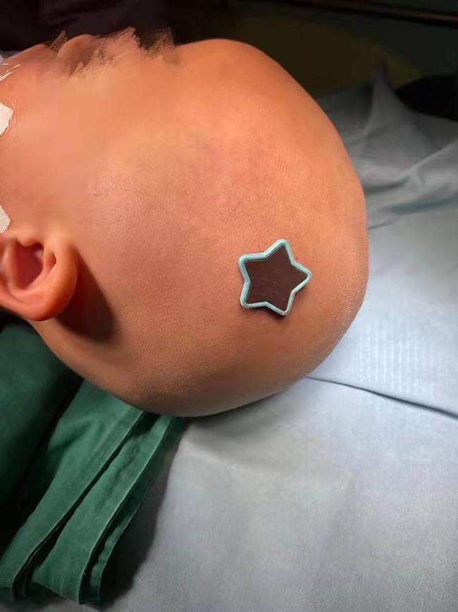 客厅吊灯坠落险砸中男童 最担心的事情发生了