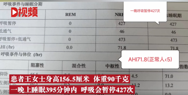 女子睡觉时呼吸暂停427次：都是肥胖惹的祸