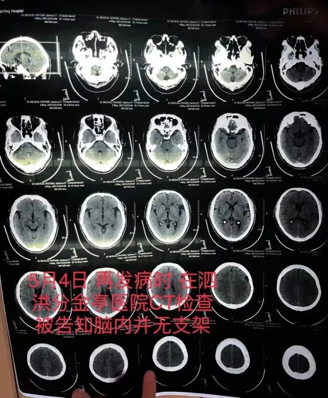 医院谈医生隐瞒手术失败：目前不方便说