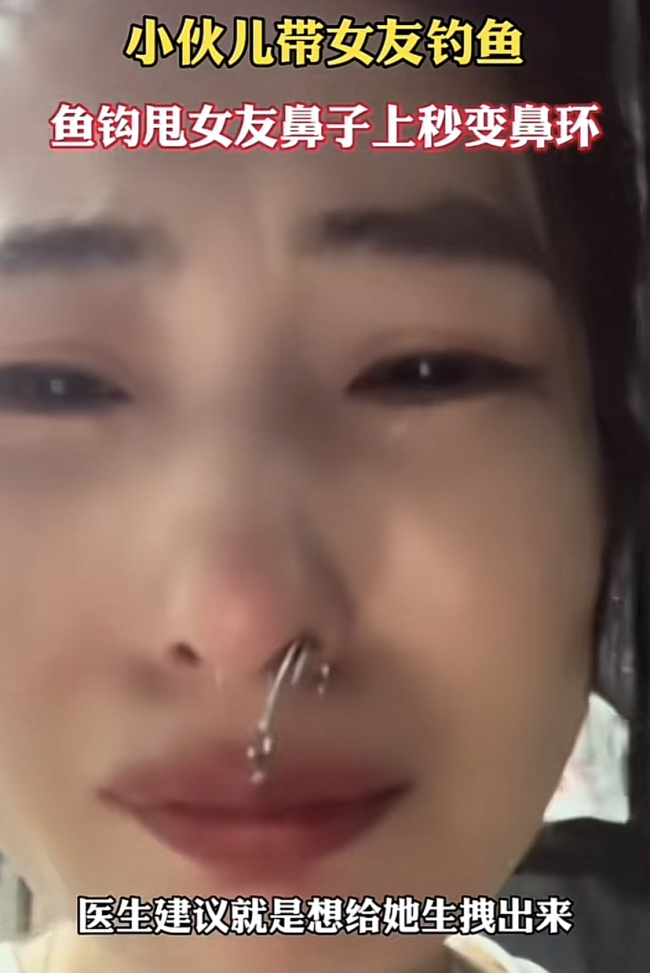 山东一男子把鱼钩甩女孩鼻子上秒变鼻环 又好气又好笑