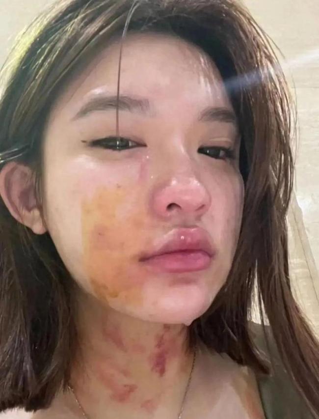 女子被殴打扒衣服后续，不满认定吞服安眠药