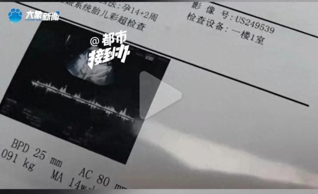 记者说,无论是唐筛还是彩超,(胎儿)都是正常的