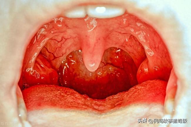 喉咙中间的小舌头有什么用？功能繁多不可或缺！