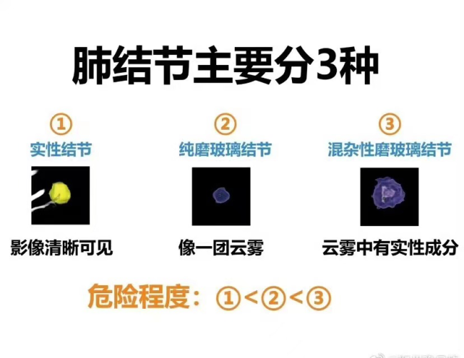 參與體檢者約一半查出肺結節5查出肺癌這兩種情況要當心