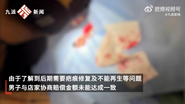 花百元理发耳朵被剪掉一块肉
