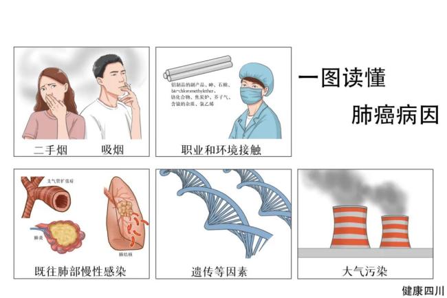 肺结节就是肺癌？哪些肺结节容易癌变？医生提醒：这几种千万要当心