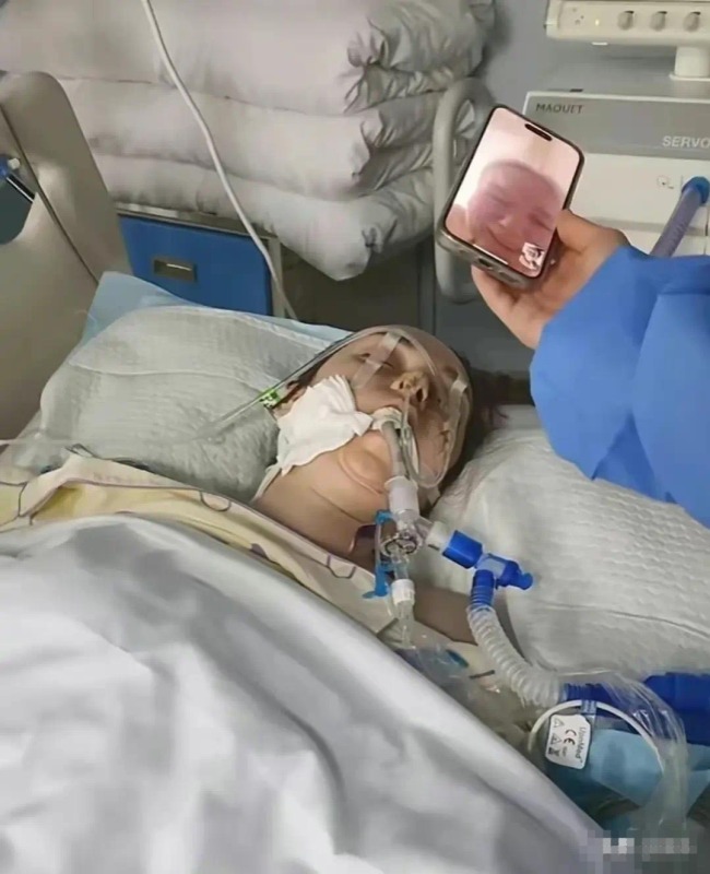 31岁网红俄罗斯娜娜去世 酒后吃药昏迷38天 悲剧警示酒后用药风险