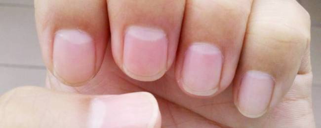 指甲的半月痕多少代表着什么？