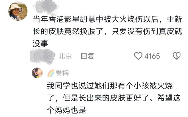 泪目！烧伤妈妈丈夫称不介意是否会留疤