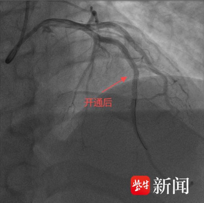   外籍患者因胸痛就醫(yī)被醫(yī)生強(qiáng)行留院