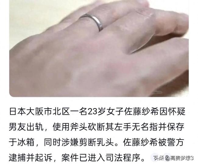 日本女人切断了男友的戒指,这种强烈的行为激