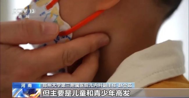 4歲孩子高燒不退,，竟然患上“親吻病”,，癥狀速查