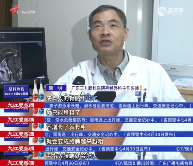 男子突然變丑 下唇比上唇厚一倍 竟是垂體瘤作祟