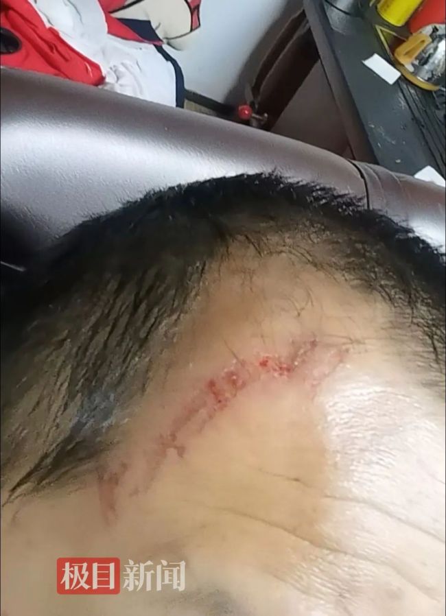 景區(qū)飛天魔毯失控游客被甩出 設(shè)備故障疑引發(fā)事故