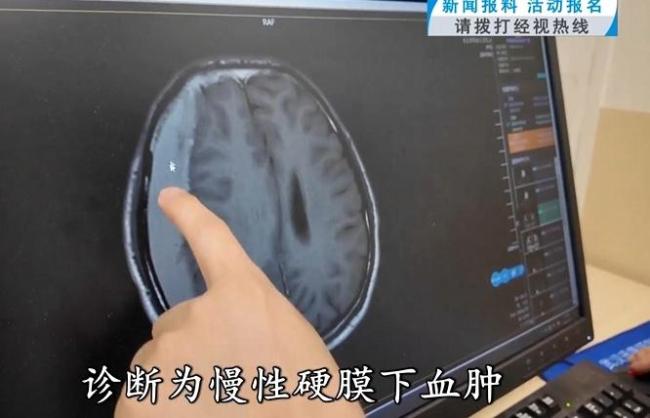 37歲男子連坐兩次過山車突發(fā)顱內(nèi)出血 醫(yī)生提醒這些患者坐過山車需謹(jǐn)慎