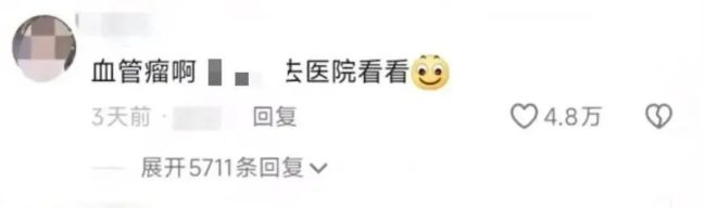 女生曬照被網(wǎng)友看出血管瘤 網(wǎng)友：默默打開手電筒
