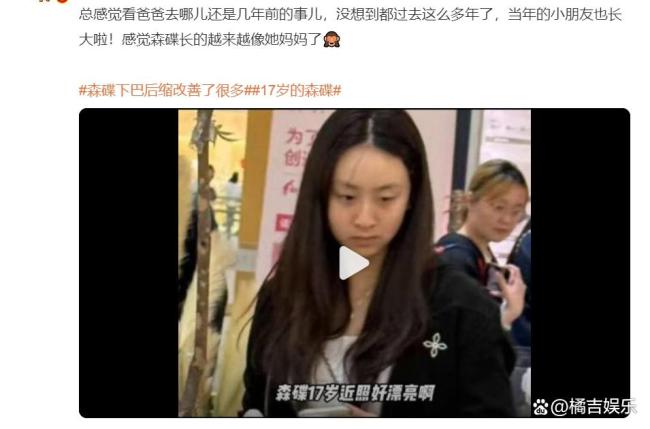 森碟下巴后縮改善了很多 青春魅力綻放