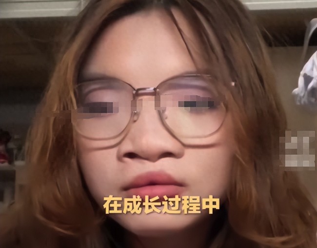 先天性唇腭裂女孩哭訴遭惡評(píng) 呼吁停止外貌攻擊