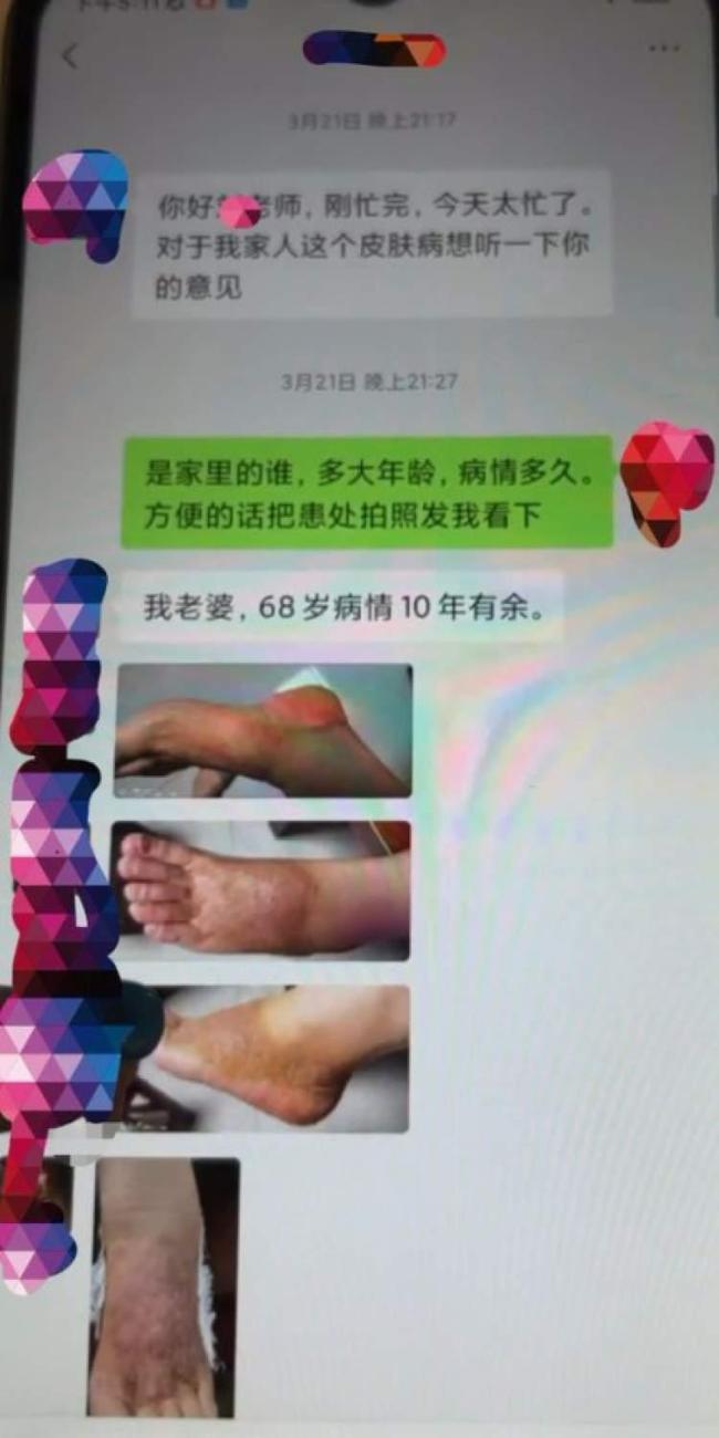 花高價(jià)買老中醫(yī)秘方實(shí)為普通抑菌膏