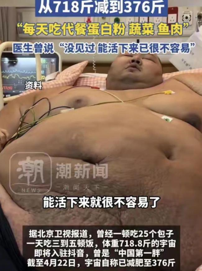 “中國第一胖”切掉70%的胃 體重降至490斤,!