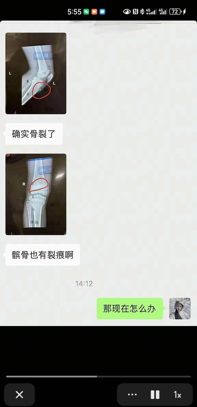 從“免費踢球”到“18萬贖身”,，是孫繼海的青訓模式錯了嗎？