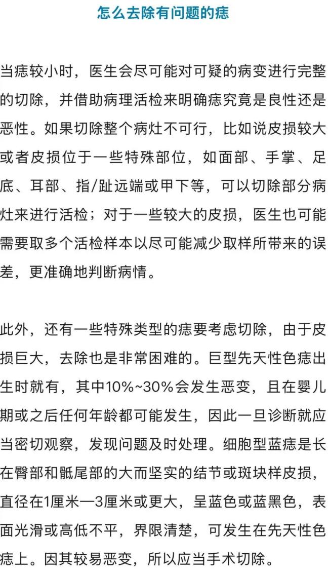 長(zhǎng)了痣到底要不要除掉 專家建議關(guān)注“問題痣”