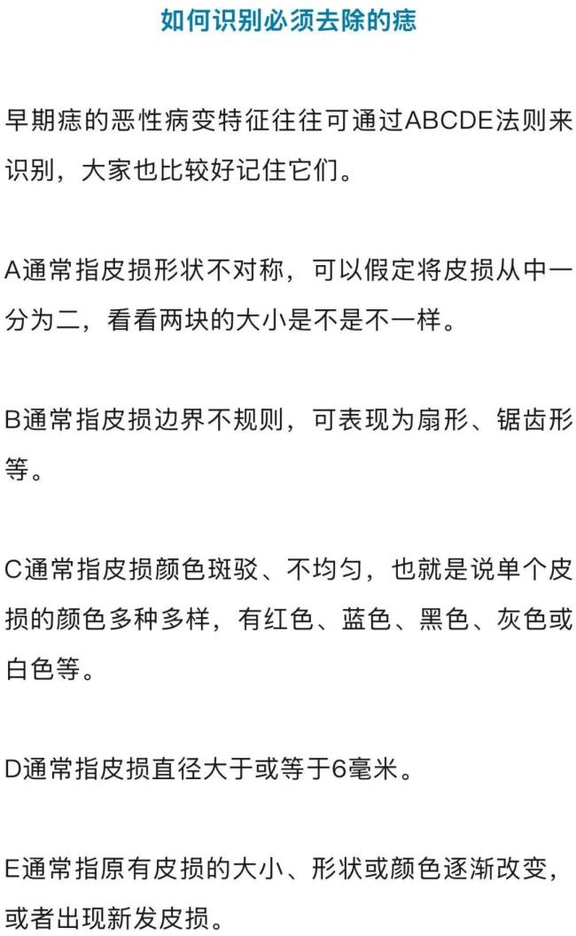 長(zhǎng)了痣到底要不要除掉 專家建議關(guān)注“問題痣”