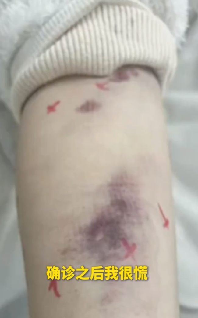 17歲少女高考前查出白血病堅(jiān)持學(xué)習(xí)