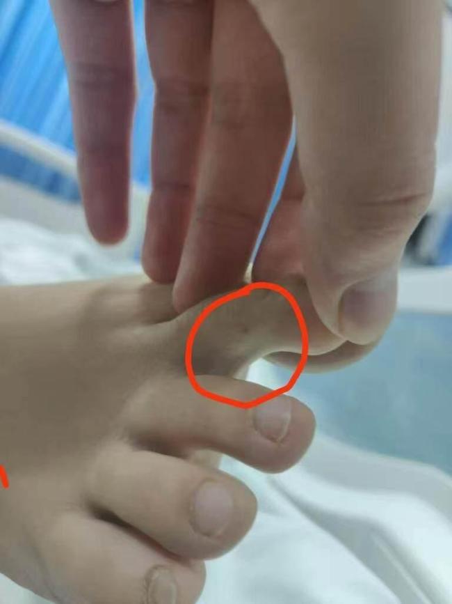 疑被蛇咬傷身亡女子表弟發(fā)聲 質(zhì)疑醫(yī)院診治不當(dāng)