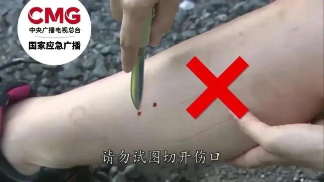 三亞衛(wèi)健委通報(bào)女游客就診細(xì)節(jié) 不明物咬傷致死引發(fā)關(guān)注