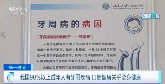 “韋神”的牙齒問題其實很多人都有 牙周炎成健康隱患