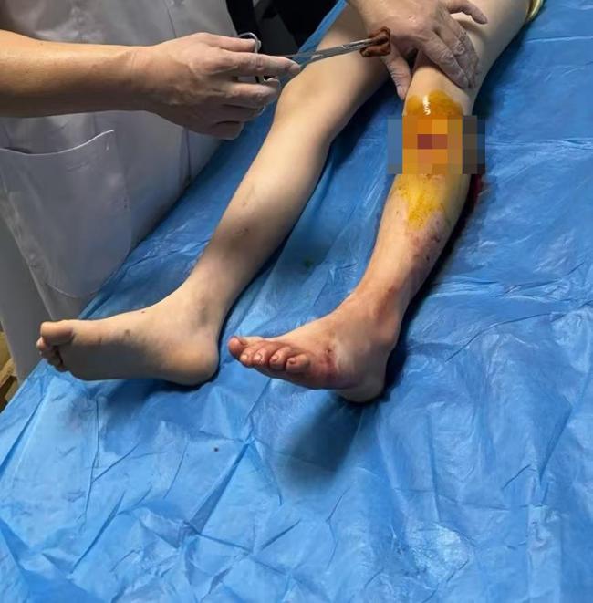 多名孩子在景區(qū)水池被瓷磚割傷 游玩變傷痛