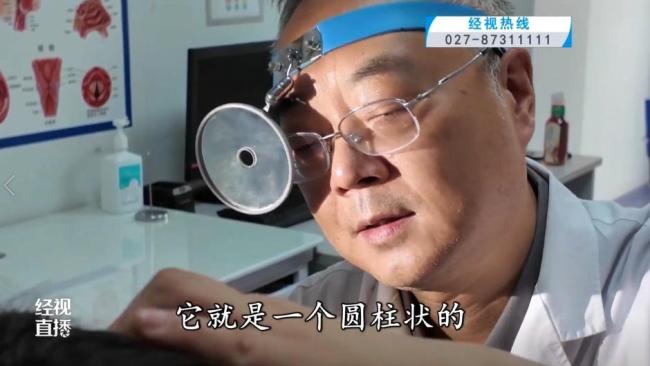 女童耳痛就醫(yī)挖出所藏橡皮擦