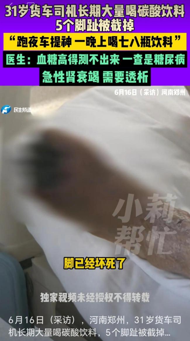 31歲貨車司機(jī)長期大量喝碳酸飲料,，5個腳趾被截掉