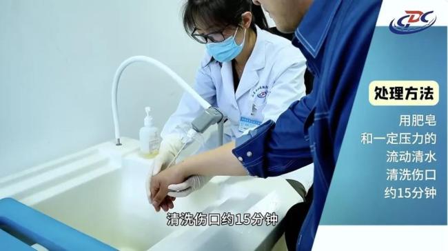 被貓狗抓咬傷后應(yīng)及時就醫(yī) 以免發(fā)生意外