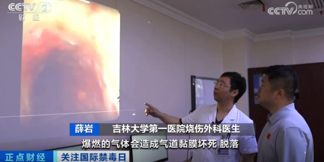 18岁少年全身严重烧伤 只因和朋友“上劲”玩这个