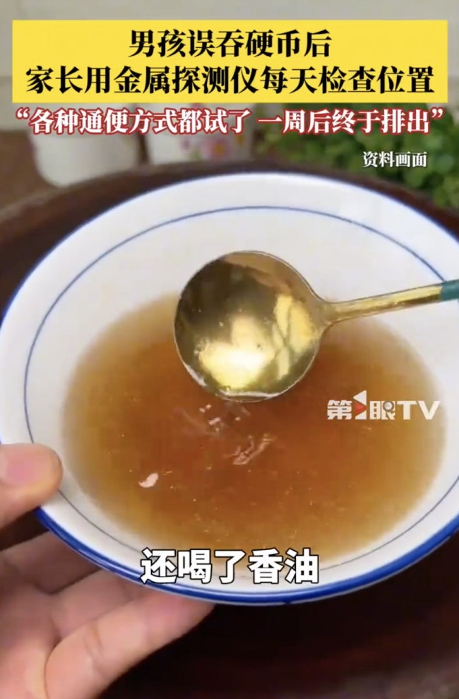 男孩误吞硬币家长用探测仪检查位置！