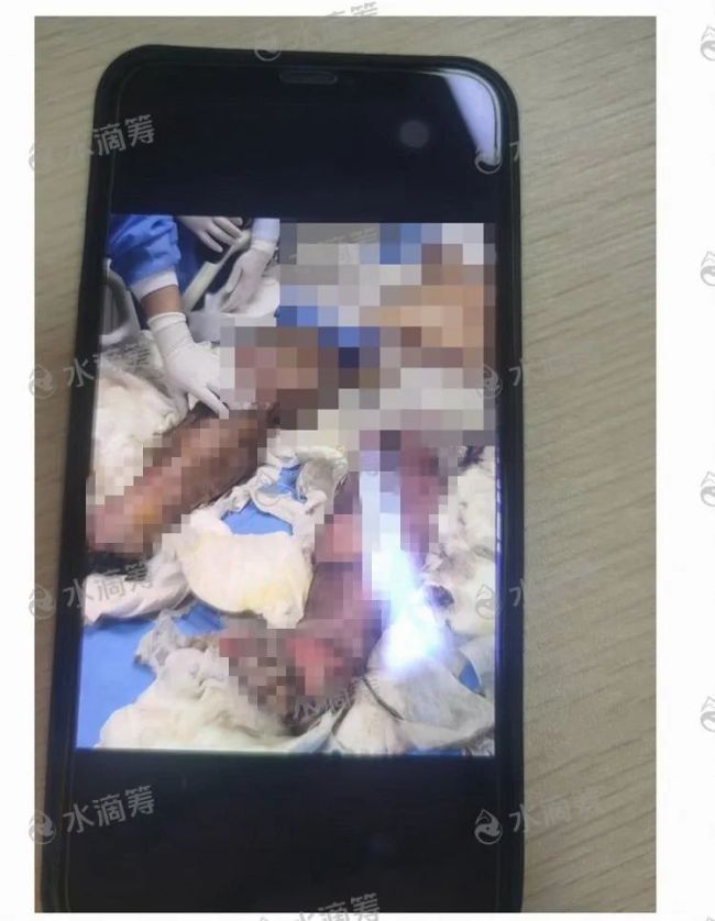 成都火灾重伤女孩中考完被提前录取，电瓶车“飞线充电”引发火灾