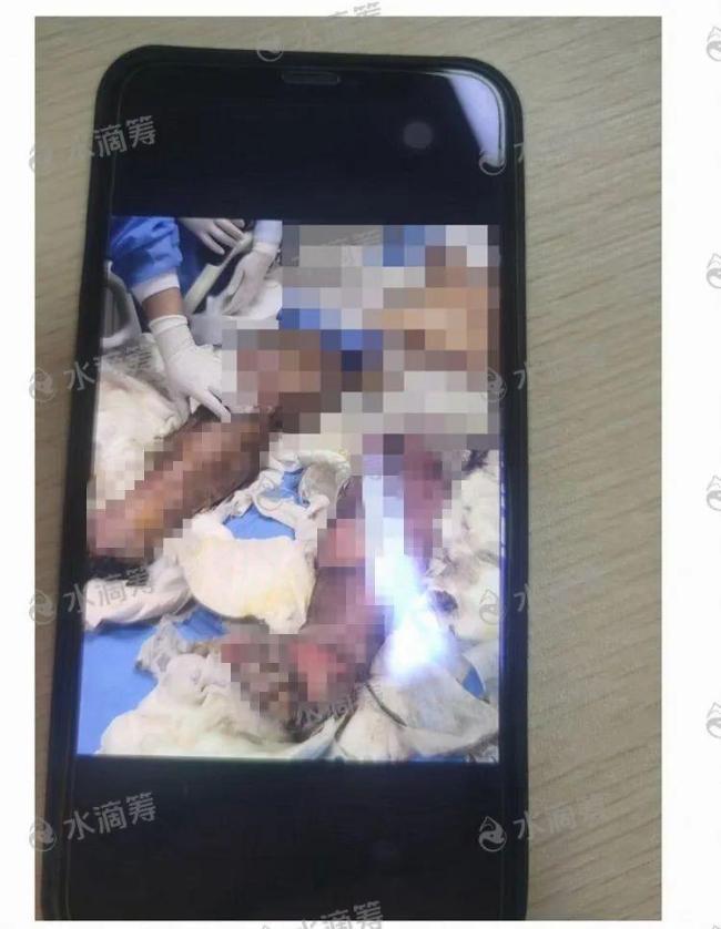 电动自行车引发火灾一家四口1死2伤