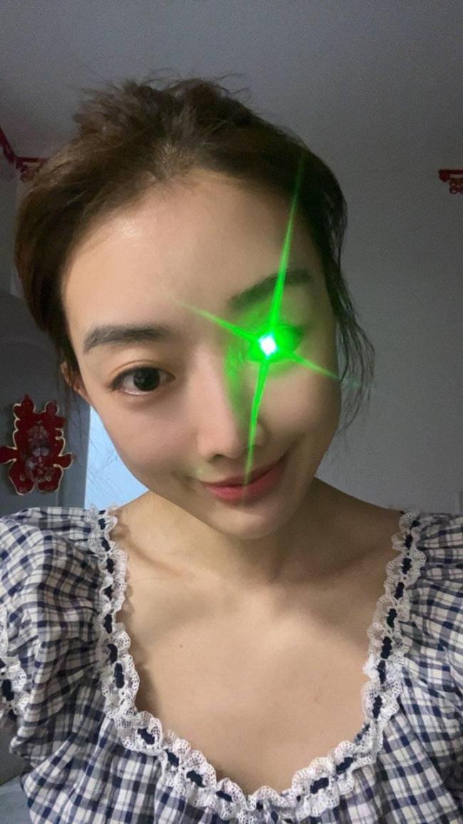 90后單眼女生為數(shù)百人做第二只眼睛 點(diǎn)亮自信重生之路