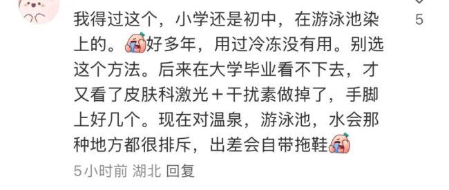 网友住酒店光脚洗澡感染HPV 跖疣病毒引发热议