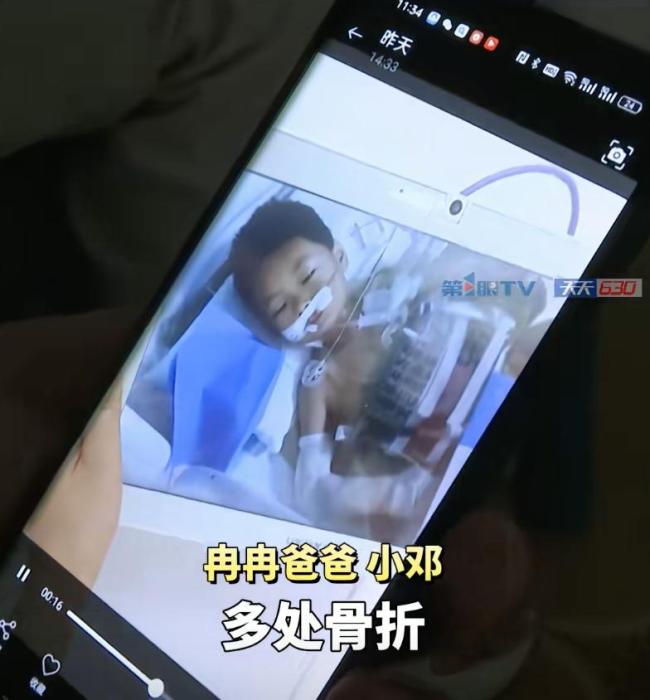 22楼坠落男孩重伤 父亲讲述现状 奇迹背后的家庭伤痛
