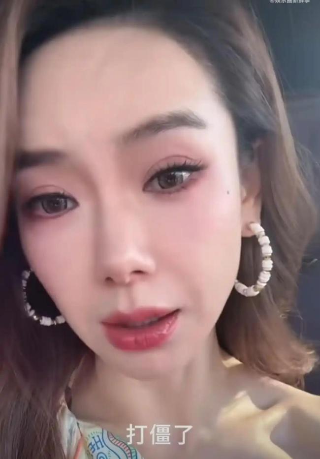 戚薇承认过度医美：打肉毒打僵了 医美翻车现场变脱口秀