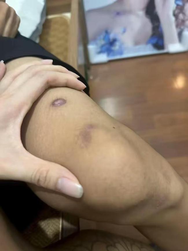 小伙被17岁同居女友卖到缅甸 恋爱脑的惨痛代价